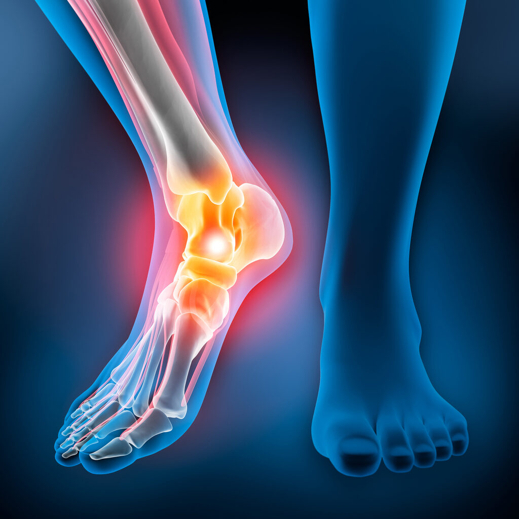 Human ankle with strong pain symptom